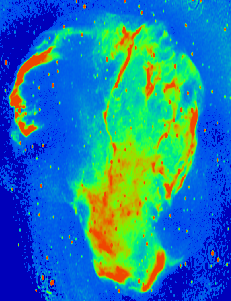 SNR Cygnus loop